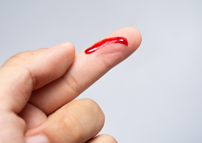 Cuts and Scrapes