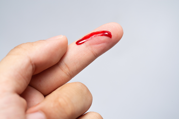 Cuts and scrapes