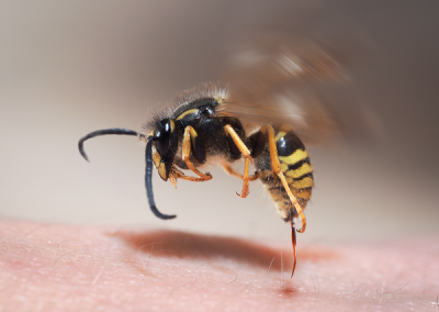 Insect Stings